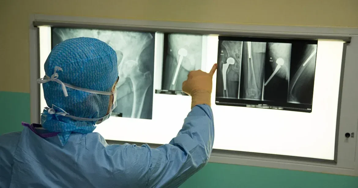 Pénzhiány a fő akadálya a műtéti várólisták csökkentésének